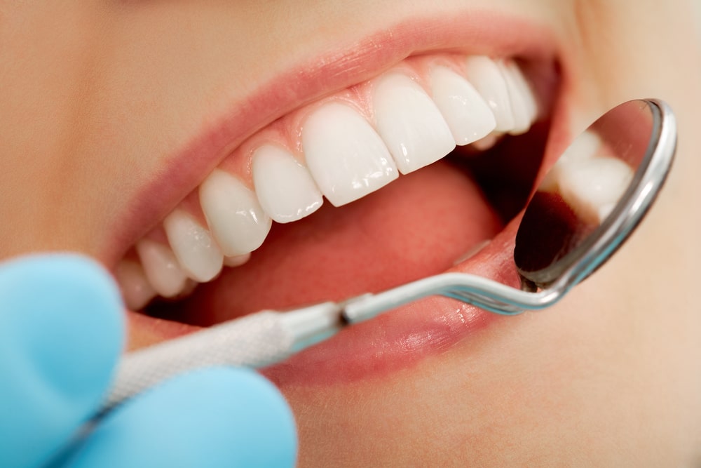 invisalign Birmingham, AL